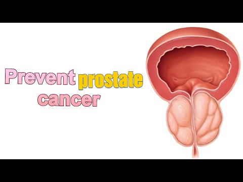 How to prevent prostate cancer at home: effective tips [Video]