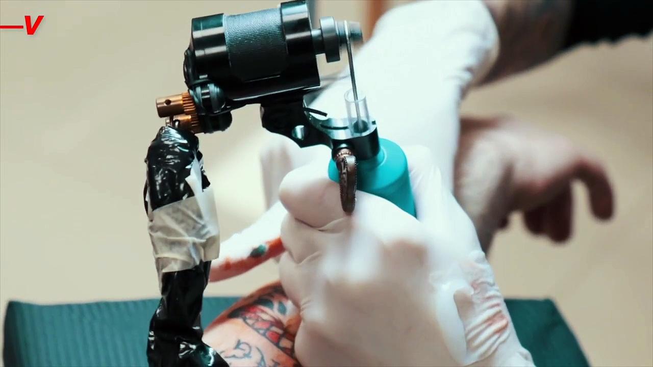 Tattoos Linked to Increased Risk of Lymphoma [Video]