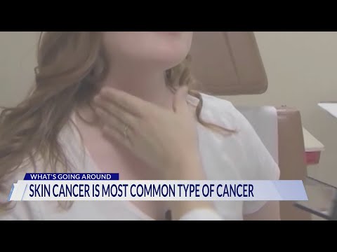 What’s Going Around: May is Skin Cancer Awareness Month [Video]