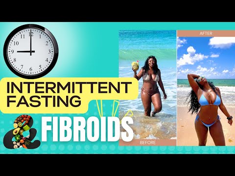 WHY INTERMITTENT FASTING DIDN’T WORK FOR ME! | FIROID EDITION [Video]