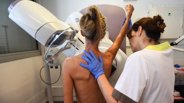 Breast screening at age 40 not routinely advised, Canadian task force says [Video]