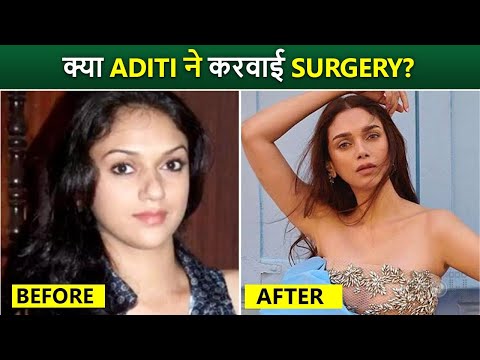 Heeramandi: Aditi Rao Hydari SHOCKING Transformer Before & After Spark Plastic Surgery Rumours [Video]