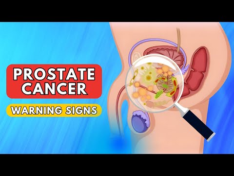 Prostate Cancer Signs | Warning Signs and Symptoms of Prostate Cancer [Video]