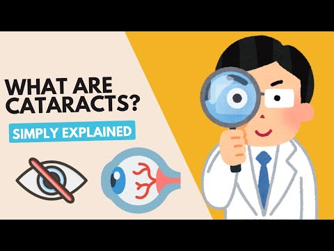 Cataracts Explained: Symptoms, Causes & Treatment Options [Video]