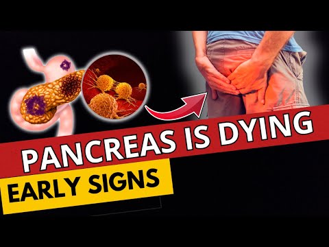 Your Body Screams About Pancreatic Issues! The First Signs of Pancreatic Disease. [Video]