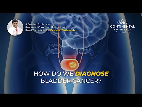 How Do We Diagnose Bladder Cancer? Dr Vineet- Consultant Urologist & Renal Transplantation [Video]