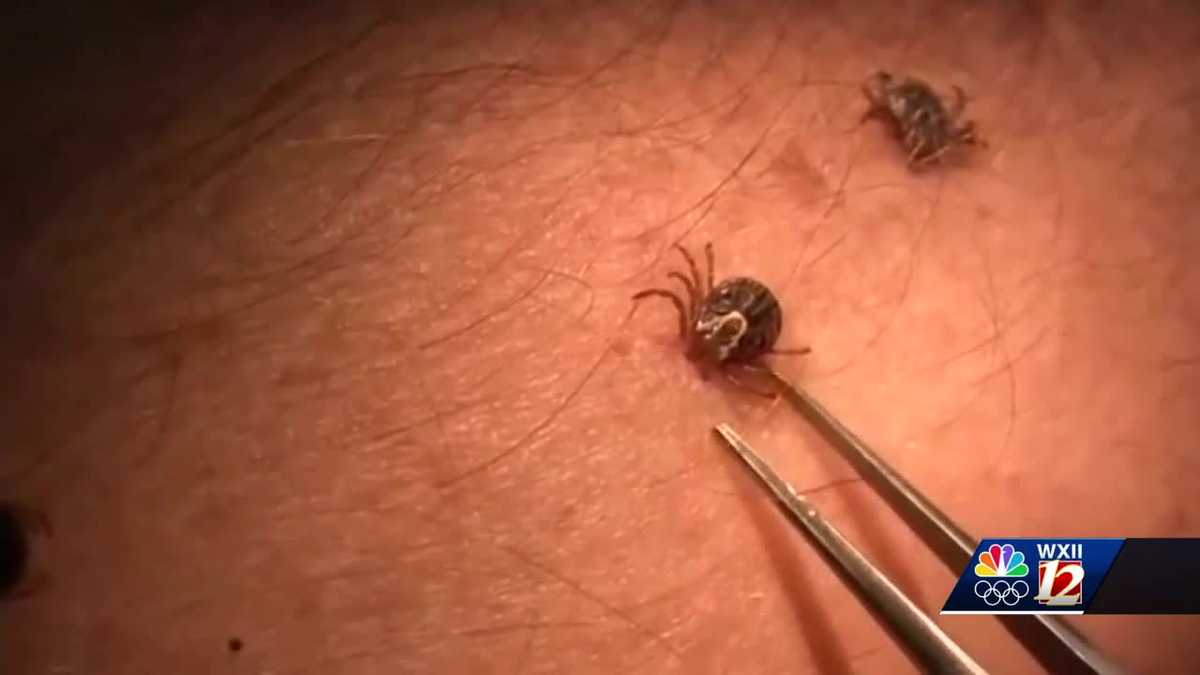 Lyme Disease cases on rise throughout North Carolina [Video]