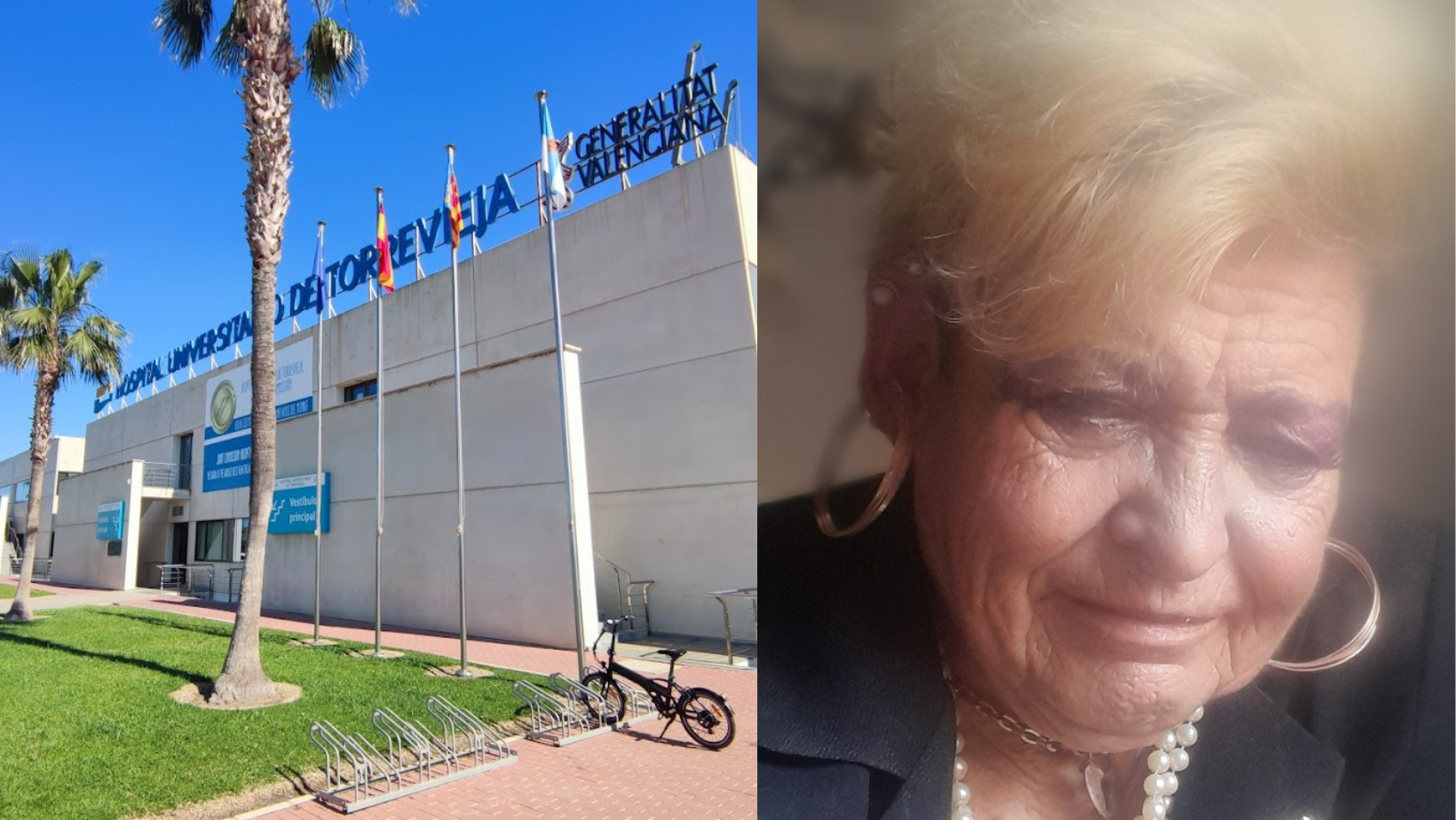 EXCLUSIVE: British woman, 72, is waiting to die from football-sized hernias in Spain after hospital staff ignored her symptoms for years and branded her a bored expat who just wanted company [Video]