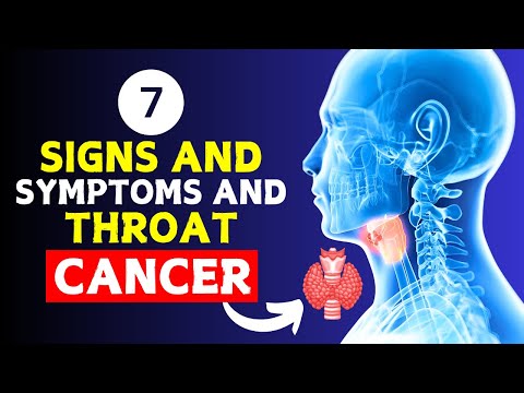 7 Signs and Symptoms of Throat Cancer [Video]