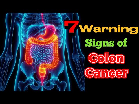 7 Warning Signs of Colon Cancer + Prevention [Video]