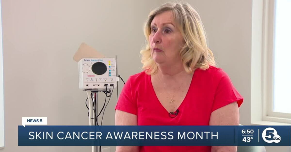 Skin cancer advocates stress importance of early detection, prevention [Video]