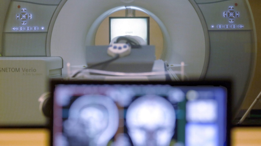 Ontario seeks more private MRI, CT clinics for public scans [Video]