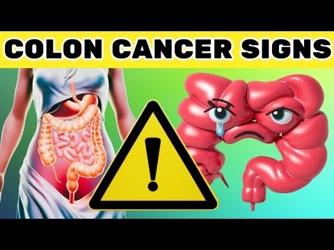 VITAL! Colon Cancer – Signs, Prevention, Cure | Key Health [Video]