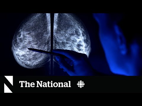 Cutting through the confusion of latest mammogram guidelines [Video]