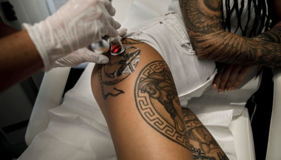 Study Highlights Potential Link Between Lymphoma & Tattoos [Video]