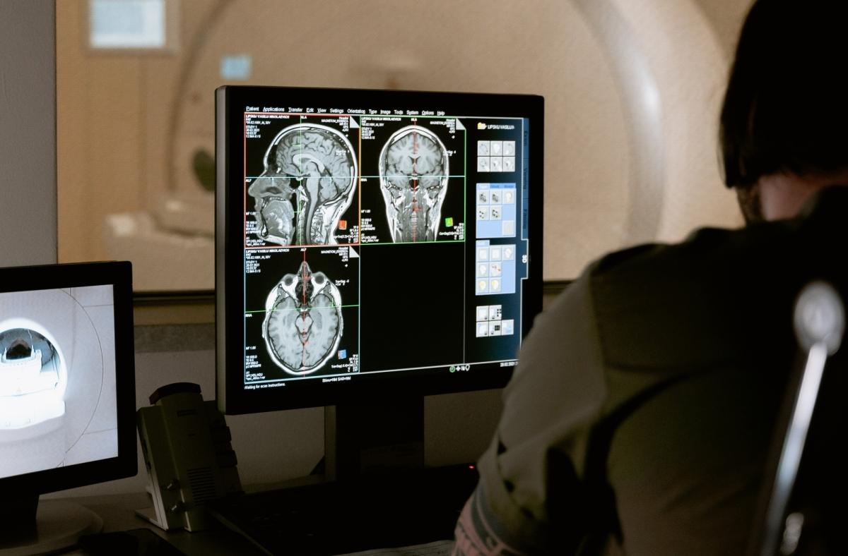 Diagnosing brain tumours early is important for better outcomes: Experts [Video]