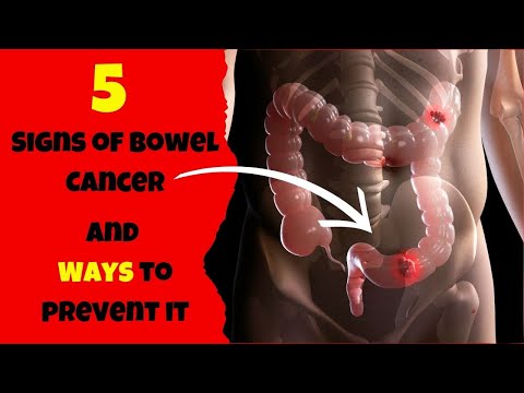 5 Signs of Bowel Cancer and Ways to Prevent It [Video]
