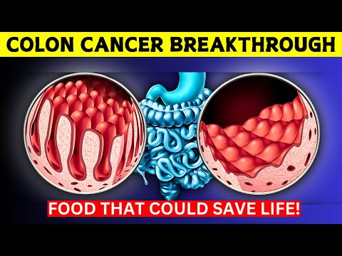 Colon Cancer Breakthrough Foods That Could Save Your Life! [Video]
