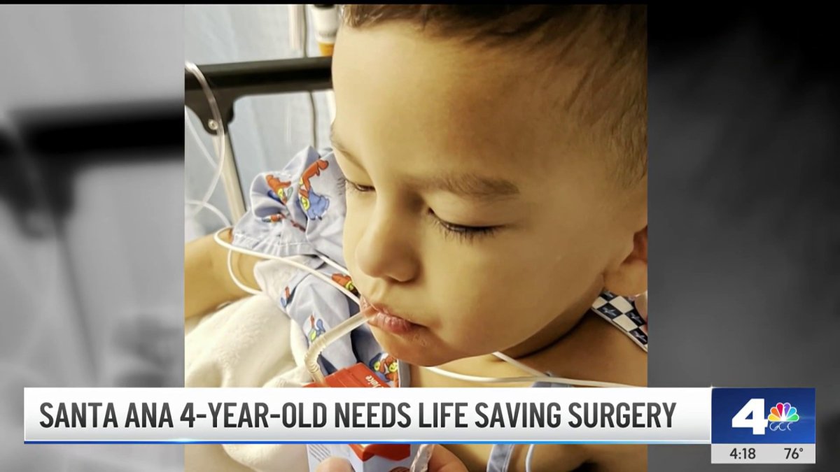 4-year-old boy in Santa Ana needs life-saving surgery  NBC Los Angeles [Video]