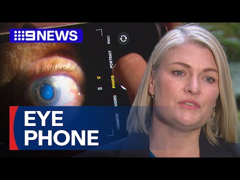 Sydney hospital testing phone gadget to help detect skin cancer risk | 9 News Australia [Video]