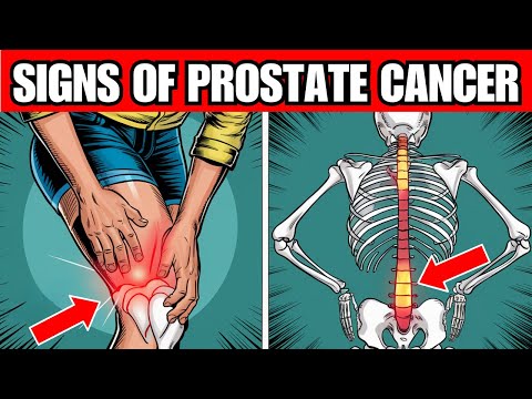 8 Warning Signs of PROSTRATE CANCER You Can’t Ignore [Video]