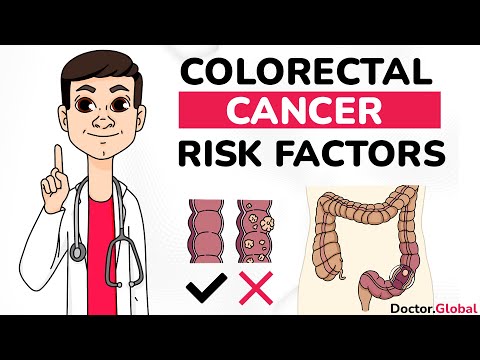 9 Risk Factors of colorectal cancer [Video]