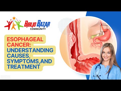 🩺 Understanding Esophageal Cancer: Symptoms, Treatment, and Care 🩺 [Video]
