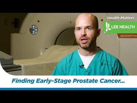 Finding Early-Stage Prostate Cancer with a PSMA PET Scan [Video]