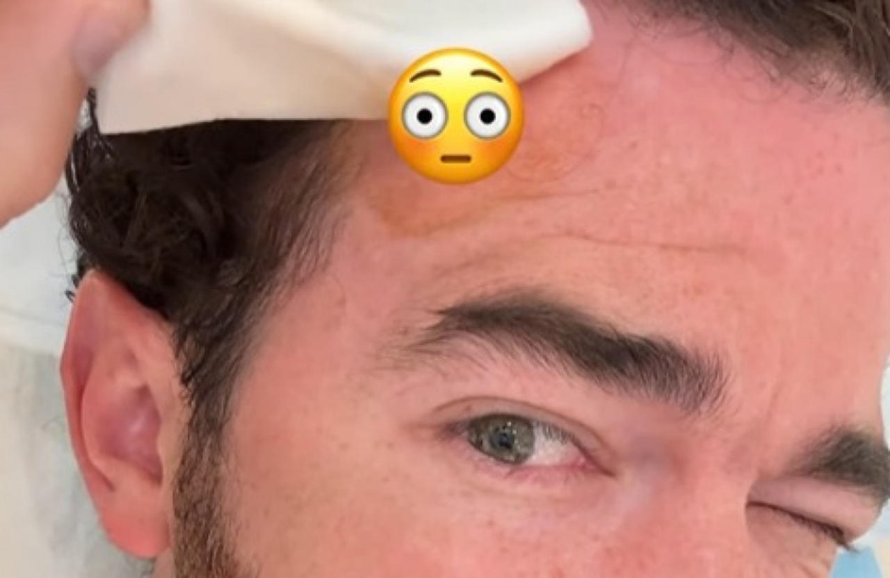 Kevin Jonas has been treated for skin cancer [Video]