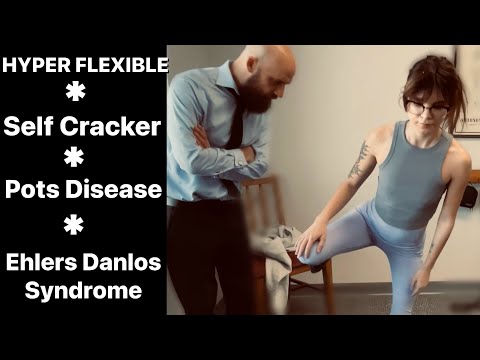 SEVERE SPINAL SHOCK *FULL BODY TREATMENT FOR COMPLEX CONDITION *EXPERT CHIROPRACTIC MORE THAN CRACKS [Video]