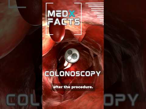 Colonoscopy procedure explained [Video]