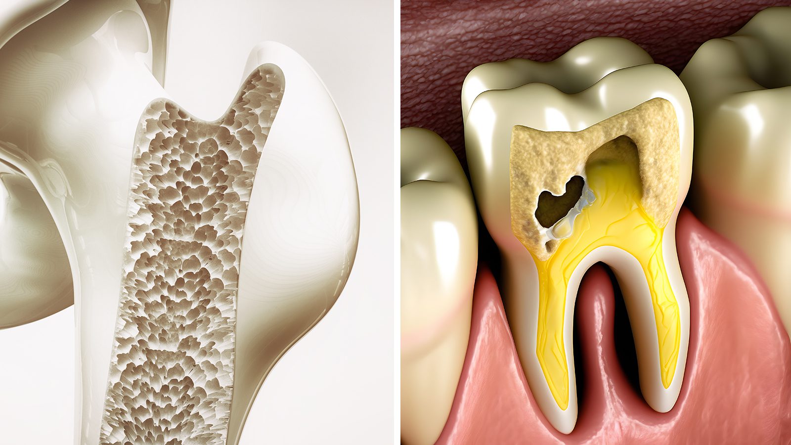 10 Things That Happen When Your Body Is Lacking Calcium [Video]