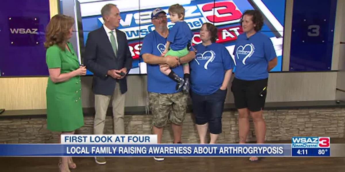 Local family raising awareness for Arthrogryposis [Video]