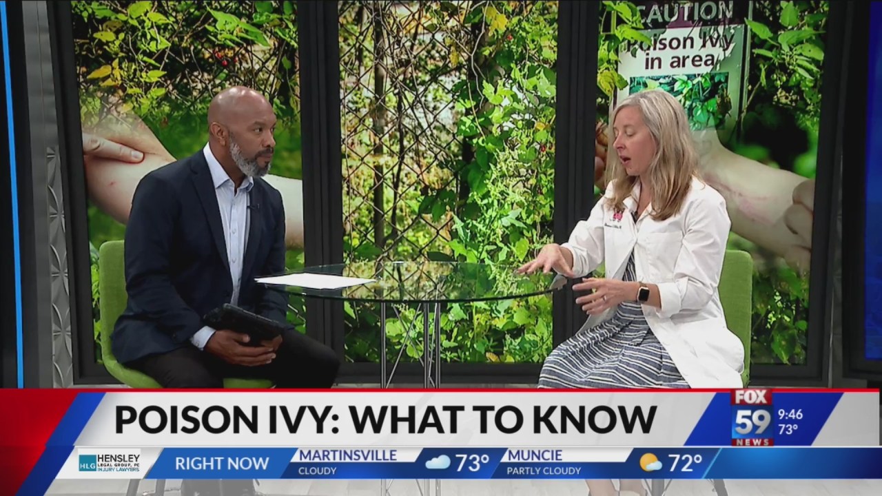 Poison Ivy: Local Pediatrician on what to know and how to treat It [Video]