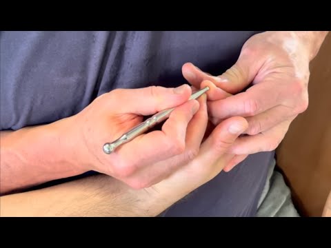 Deep hand reflexology using massage tools. How to loosen a tight hand using Raynor massage therapy. [Video]