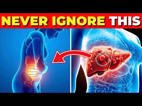 Critical Liver Cancer Symptoms You Should Never Ignore! [Video]