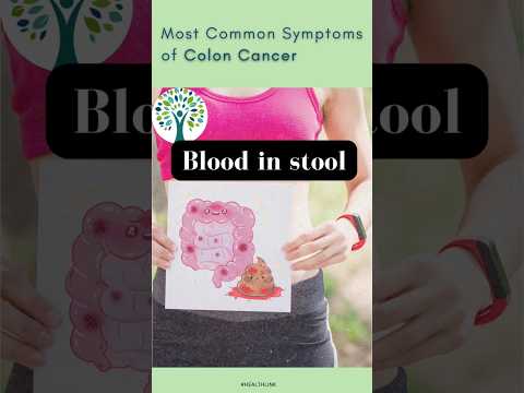 symptoms of colon cancer [Video]