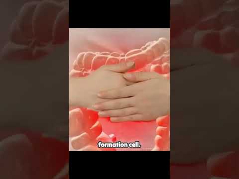 Colon Cancer: Early Signs and Symptoms [Video]