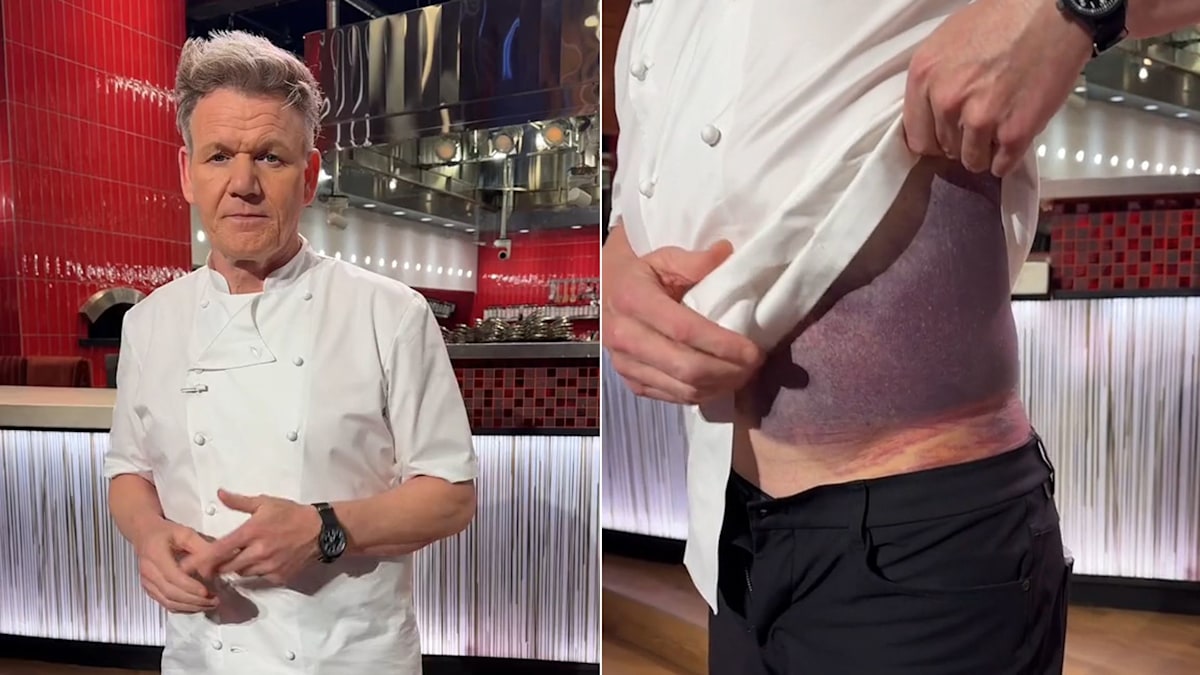 Gordon Ramsay shakes and he reveals he is ‘lucky to be alive’ after shocking accident [Video]