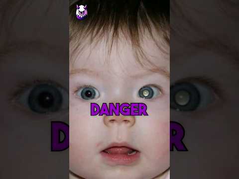 IF You see this your BABY is in DANGER! 😱 [Video]