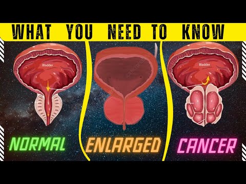 Enlarged Prostate vs. Prostate Cancer: What You Need to Know [Video]