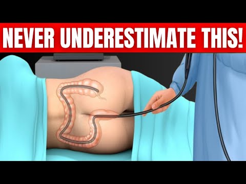 DON’T GET A COLONOSCOPY: You need to know THIS first! [Video]