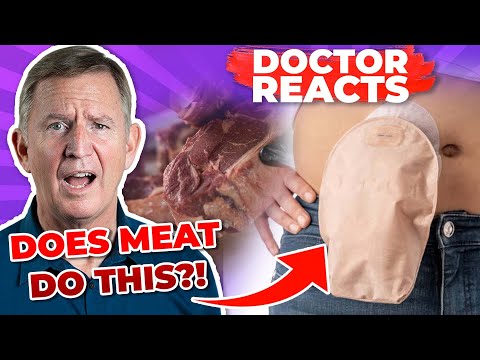 IS MEAT ROTTING YOUR COLON? (CARNIVORE DIET BEWARE!) – Doctor Reacts [Video]