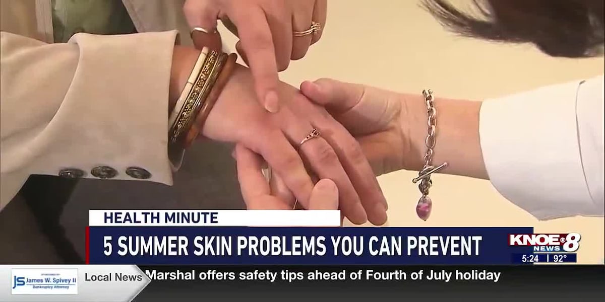 5 Summer skin problems you can prevent [Video]