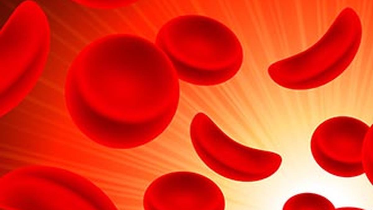 Sickle cell anemia prevalence high among tribals, say experts [Video]