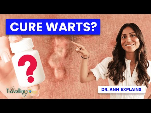 Genital WARTS: Common FAQ’s. The Ultimate Guide & Treatment Options [Video]