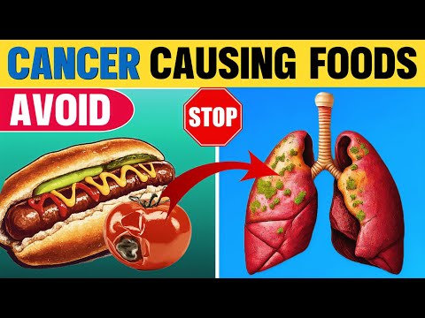 Avoid these cancer causing foods || worst foods that cause cancer [Video]