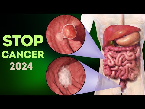 The Most Anti-Cancer Foods in 2024 [Video]