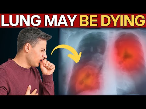 See if it could be lung CANCER, there are 10 symptoms [Video]