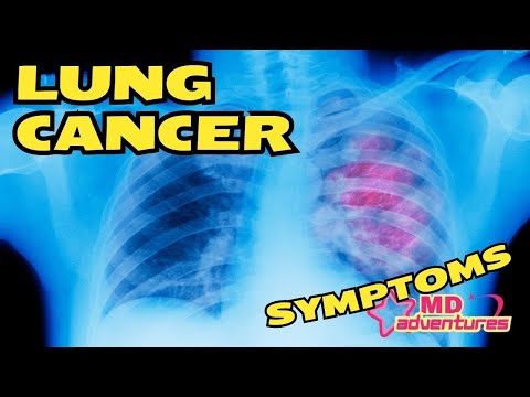 Lung Cancer. Symptoms [Video]